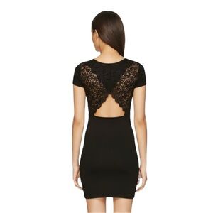 Aritzia Talula Howey Lace Back Black Dress Bodycon XXS Short Sleeve Jersey